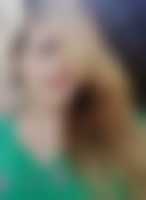 صورة العضو