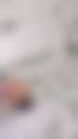 صورة العضو
